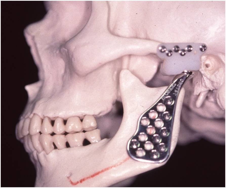 Doctus Premier Odontologia - O que é DTM? A articulação temporomandibular  (ATM) age como uma dobradiça, conectando o maxilar ao crânio. Esta  disfunção pode causar dor e desconforto. Dores na mandíbula, dificuldade