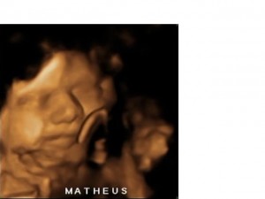 Tecnologia: imagem 3D intra-uterina de um Bebê 