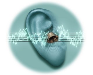 Sudden sensorineural hearing loss steroids