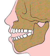 Quando a cirurgia da ATM falha - Portal Patologia da ATM