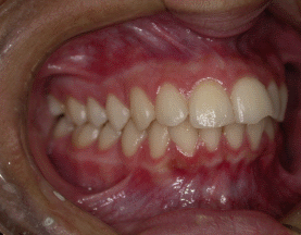 atm mandibular - Consulta Ideal