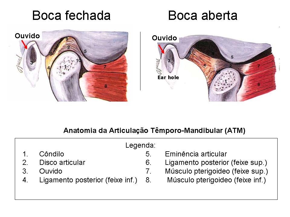 DTMSbaraini - Problemas crônicos na ATM costumam ser classificados como  Disfunção da Articulação Temporomandibular (DTM). Aqui, estão incluídos  sintomas como mandíbula estalando, dores de cabeça frequentes e até mesmo  dificuldades para abrir