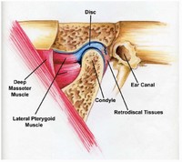 De uma Mandíbula Travada para a Osteoartrite: Descoberta do Hadassah Leva a  Novo Tratamento - Hadassah Brasil