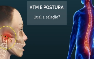 Qual a relação entre a ATM e a postura?