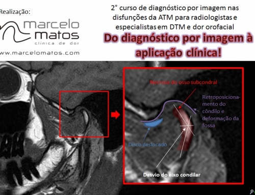 2º Curso de Diagnóstico por Imagem para Especialistas em DTM e radiologistas