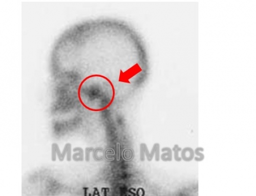 O que muda no diagnóstico quando o profissional está melhor preparado para interpretar as imagens?