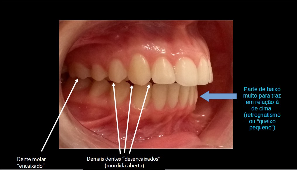 atm mandibular - Consulta Ideal